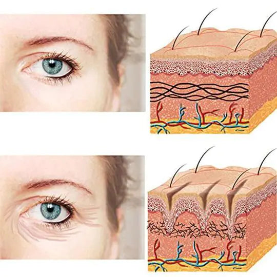 LumiLift Oog- & Voorhoofd Patches